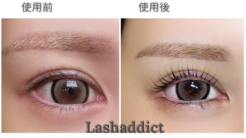 さーぽんラッシュアディクトビフォーアフター