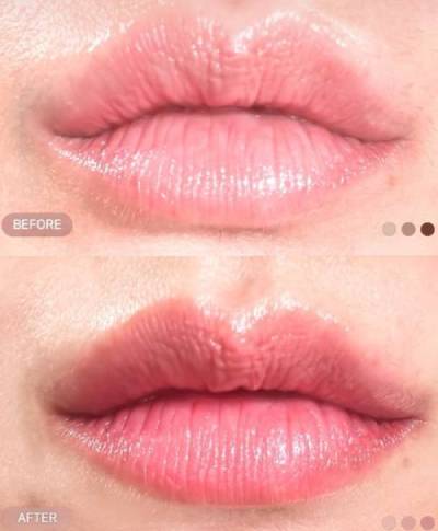 Dr. Melanin Labo TOKYOの症例画像