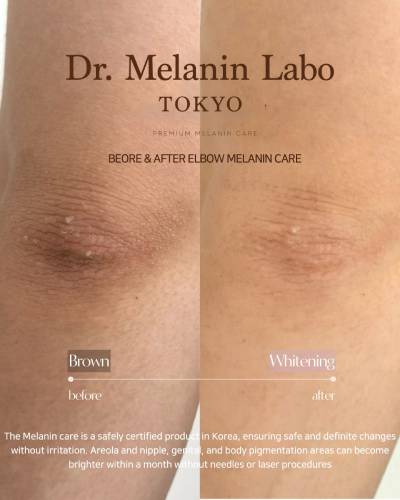 Dr. Melanin Labo TOKYOの症例画像