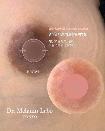 Dr. Melanin Labo TOKYOの症例画像