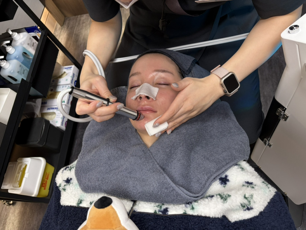 PGCクリニックでアクアピールを受けるまりあさん