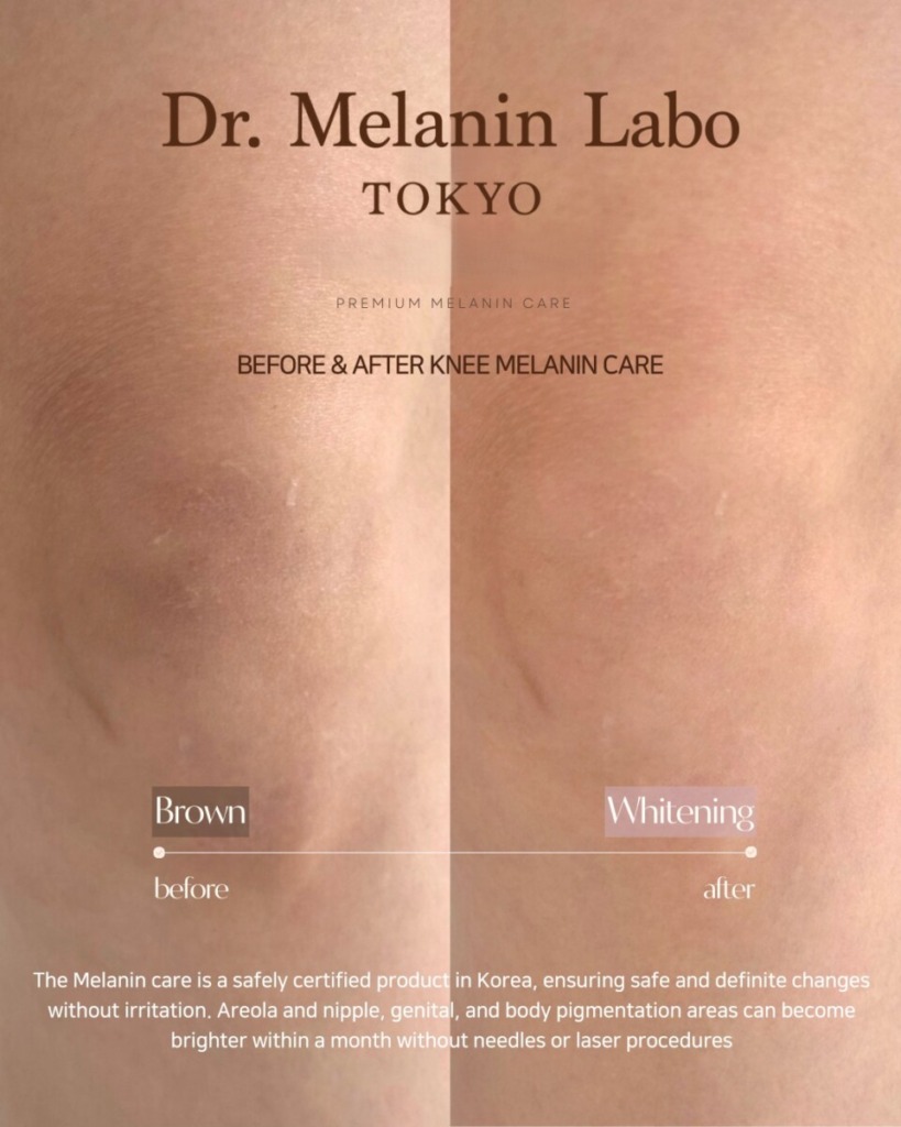 めららぼの膝のメラニンケア