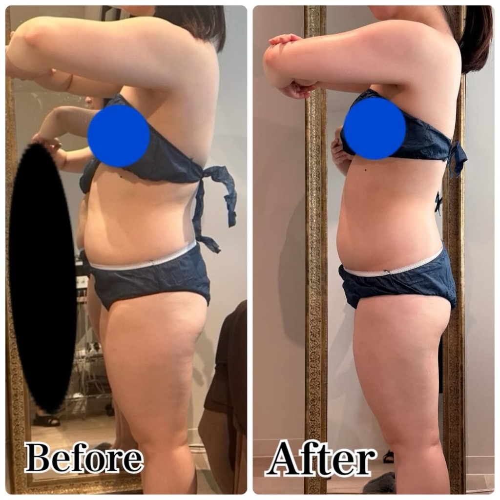 名古屋エステBIZIN｜キャバ嬢×美容メディア【Luxe Glow】美容医療・スキンケア・愛用コスメ紹介