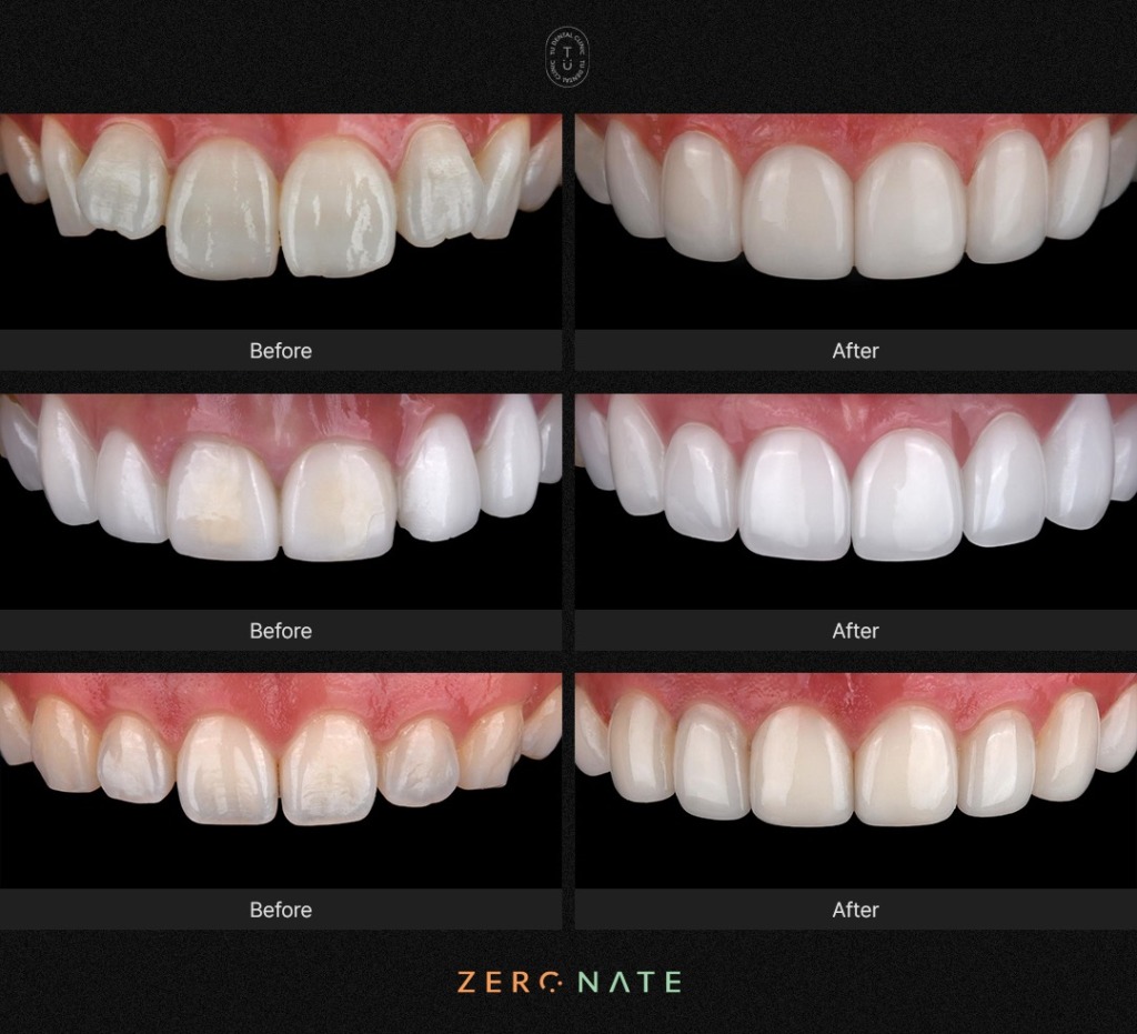 TU歯科の症例写真