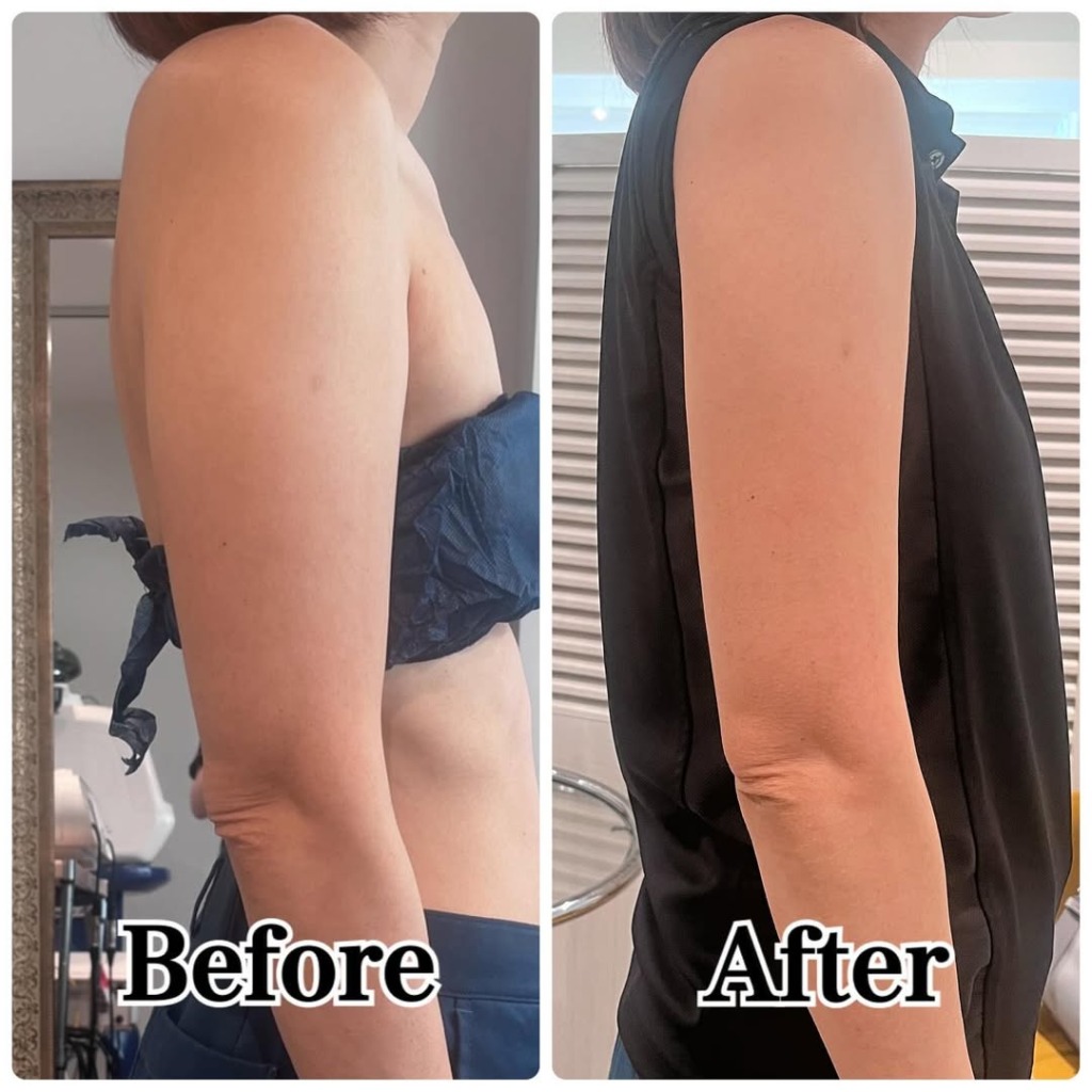 名古屋エステBIZINで話題の小顔ケア｜藤吉美千代さんの施術とは｜キャバ嬢×美容メディア【Luxe Glow】美容医療・スキンケア・愛用コスメ紹介