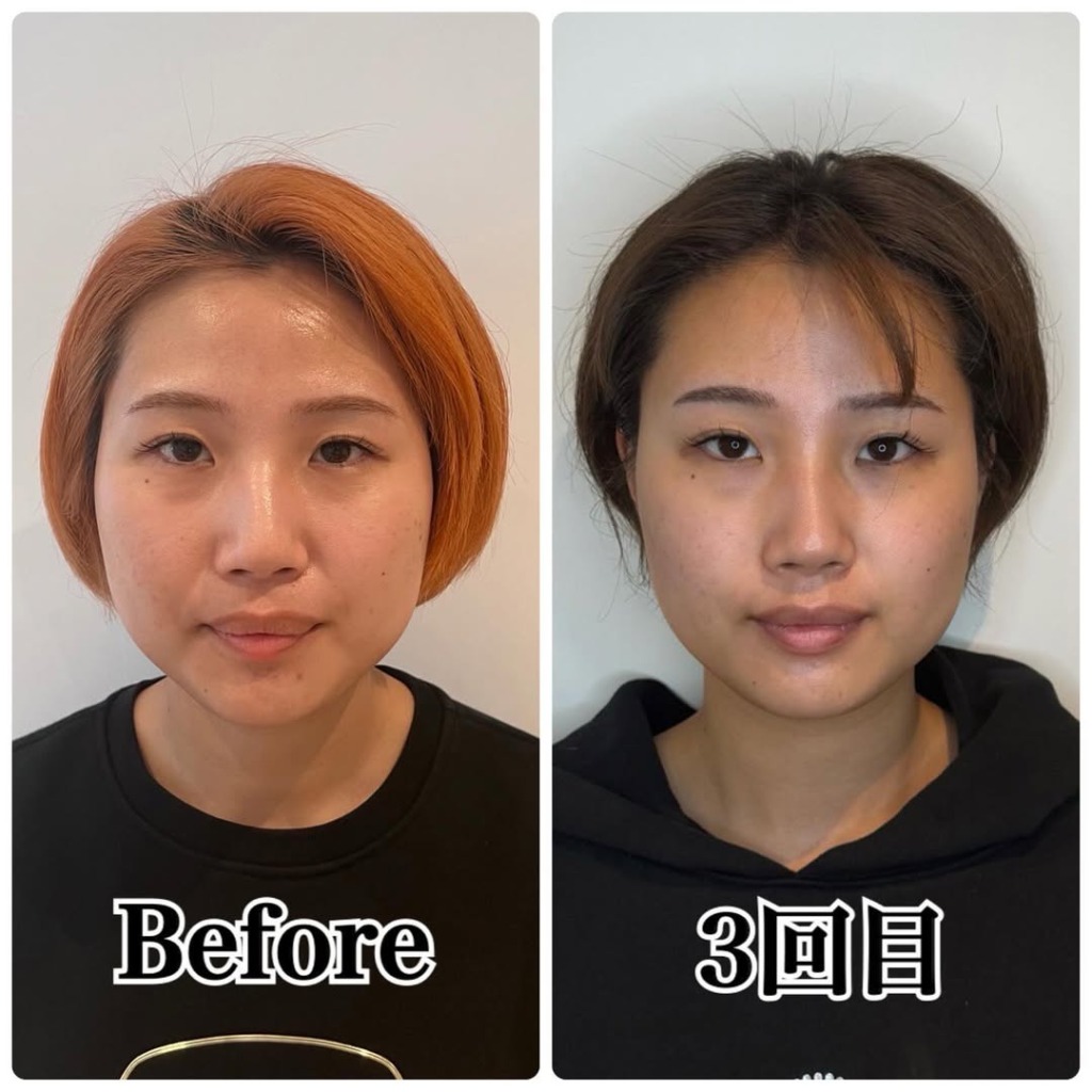 名古屋エステBIZINで話題の小顔ケア｜藤吉美千代さんの施術とは｜キャバ嬢×美容メディア【Luxe Glow】美容医療・スキンケア・愛用コスメ紹介