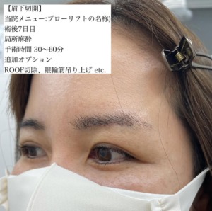 豊胸の実力派ドクター・冨田壮一院長インタビュー!LUVO CLINIC TOKYO|キャバ嬢×美容メディア【Luxe Glow】美容医療・スキンケア・愛用コスメ紹介