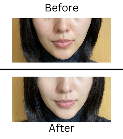 キャバ嬢×美容メディア【Luxe Glow】美容医療・スキンケア・愛用コスメ紹介